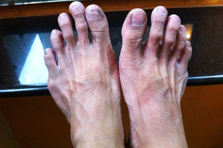 dirty feet, bangalore